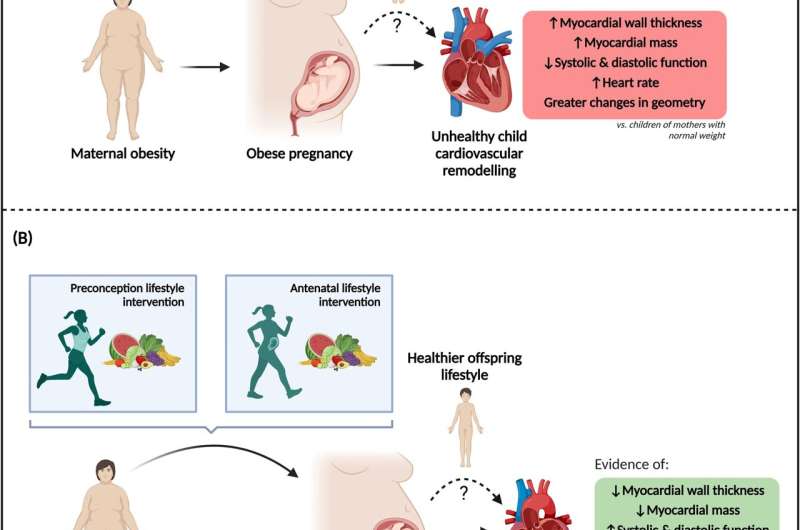 Diet and exercise for obese mothers could lower cardiovascular risk in children