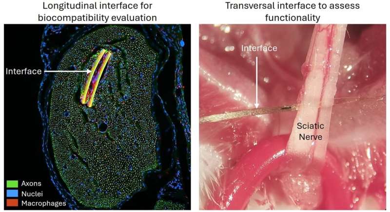 A new material derived from graphene improves the performance of neuroprostheses