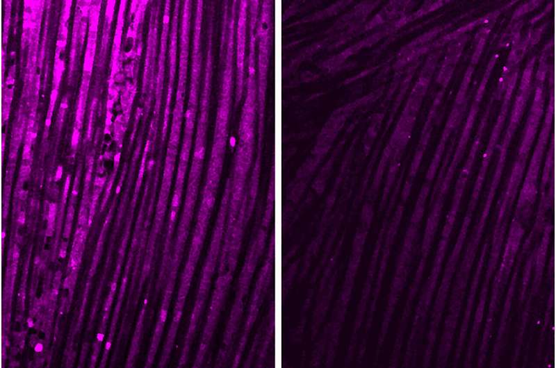 Scientists identify possible way to block muscle fatigue in long COVID, other diseases