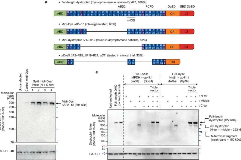 New gene therapy for muscular dystrophy offers hope