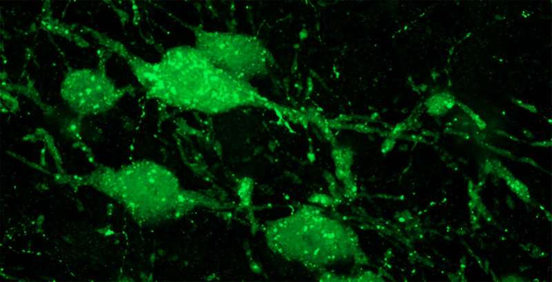 Brain circuit discovery illuminates circadian rhythms, psychiatric disorders with seasonal flare-ups