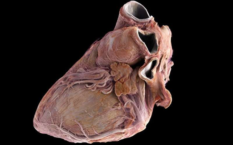 'Google Earth for the human heart' set to accelerate cardiovascular medicine