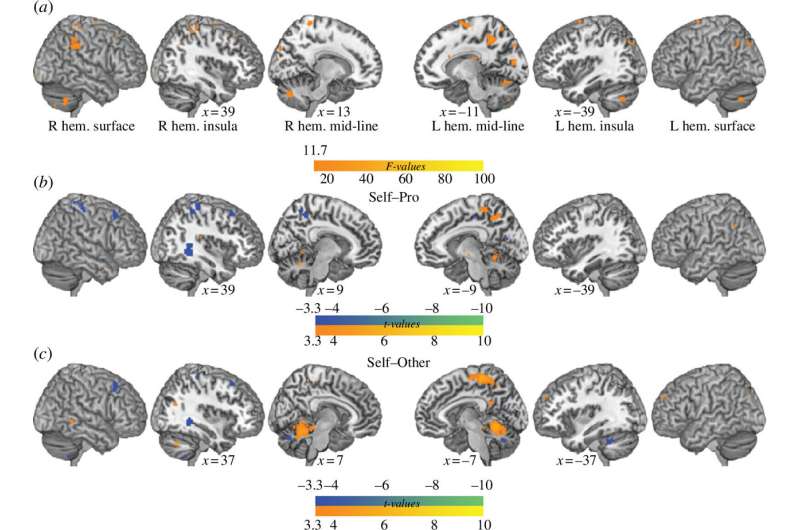 Researchers use MRI scans and karaoke to better understand the nature of blushing