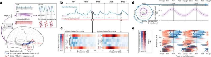 Forecasting may help people with epilepsy predict their seizures