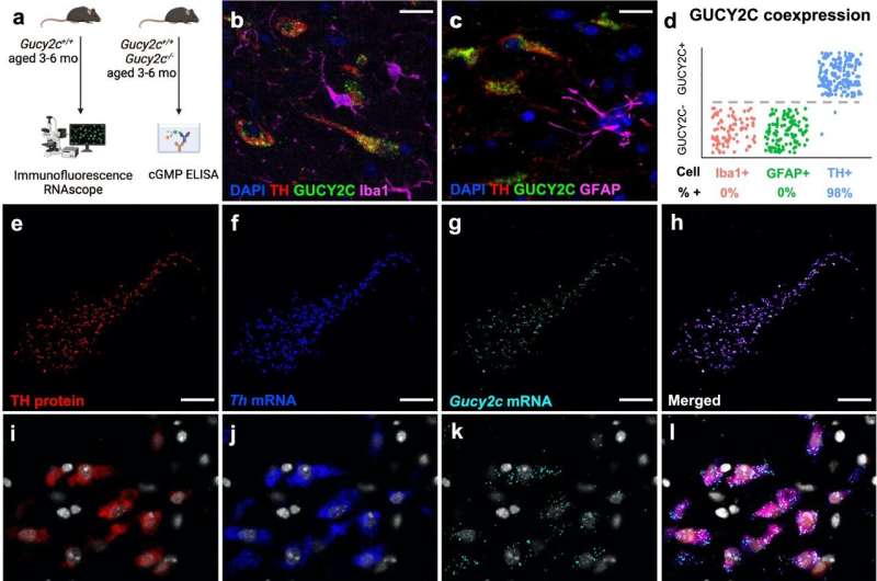 Gut protein may protect brain cells in Parkinson's disease