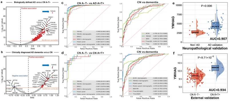 Study identifies new biomarkers of Alzheimer's disease