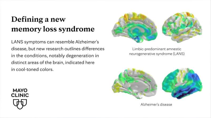 Scientists define new type of memory loss in older adults