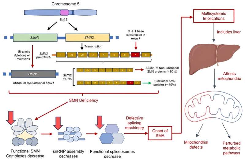 Research reveals link between spinal muscular atrophy and liver damage