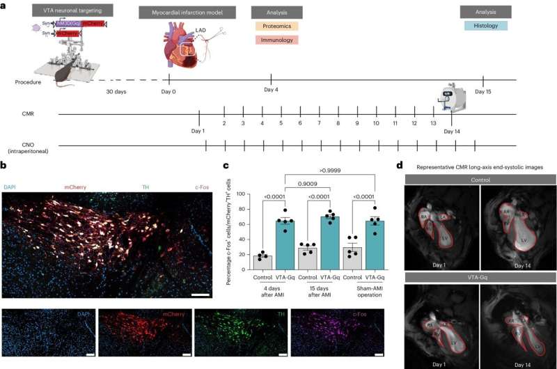 When the brain speaks, the heart feels it—the link between the brain's reward system and acute myocardial infarction