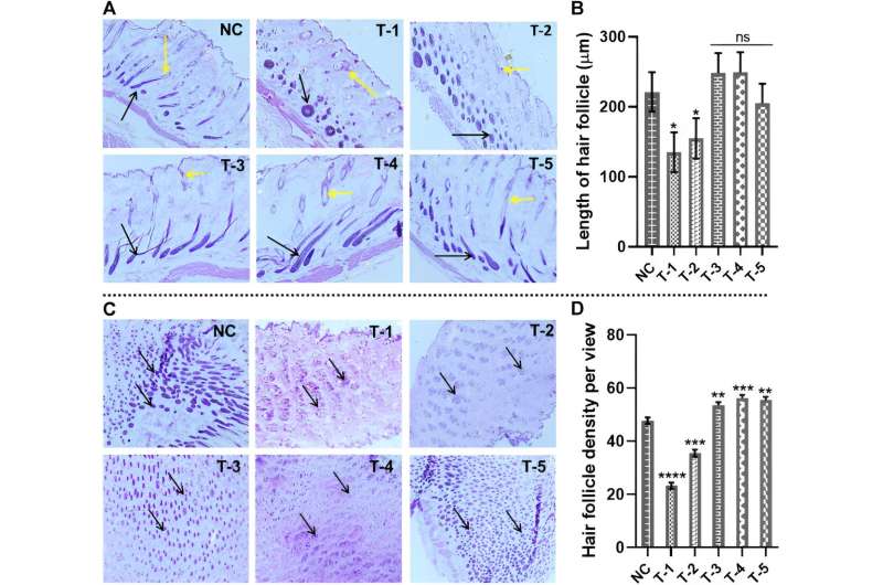 Cure for male pattern baldness given boost by sugar discovery