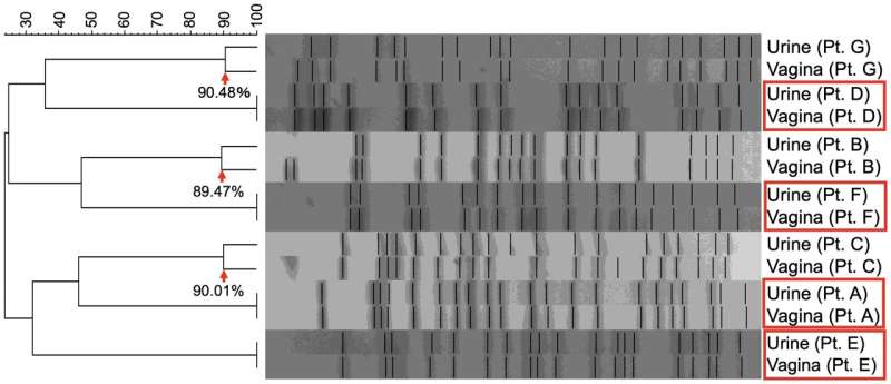 A tale of two "niches": The microbial connection between urinary bladder and vagina