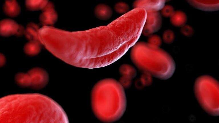 Hydroxyurea does not reduce ovarian reserve in patients with sickle cell disease, study shows