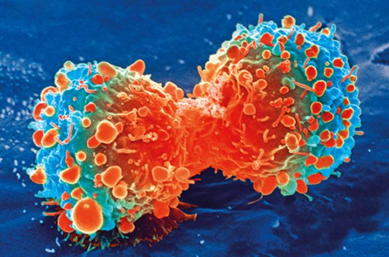 Tumor-infiltrating lymphocyte therapy marks a milestone in cancer treatment, researchers say