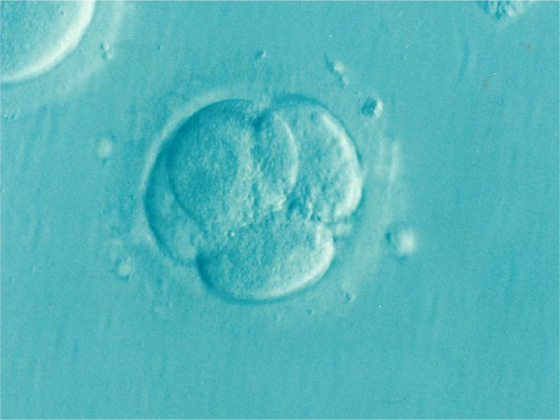 Understanding Male Infertility: A New AI-Based Approach