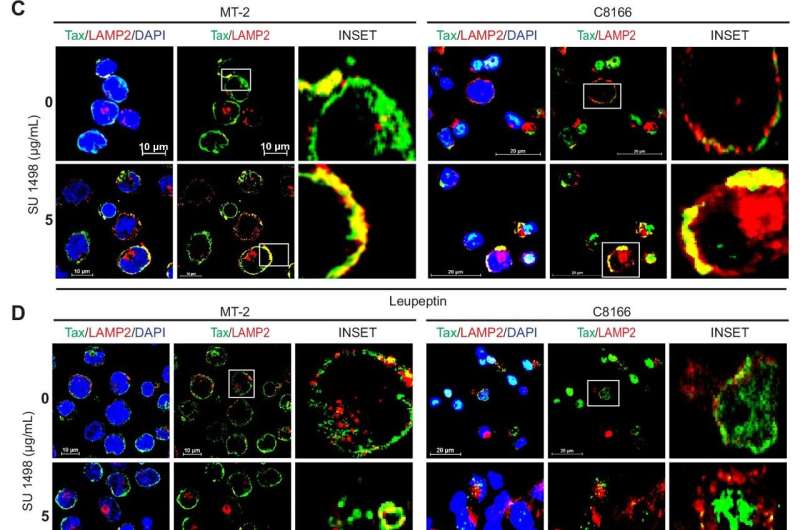 A new drug target identified for diseases associated with leukemia-causing virus