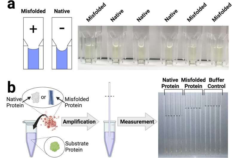 New visual technique could advance early detection of neurodegenerative diseases