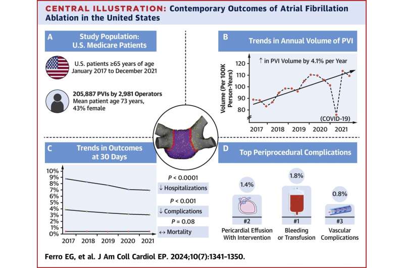 Pulmonary vein isolation is safe and effective treatment of irregular heartbeat