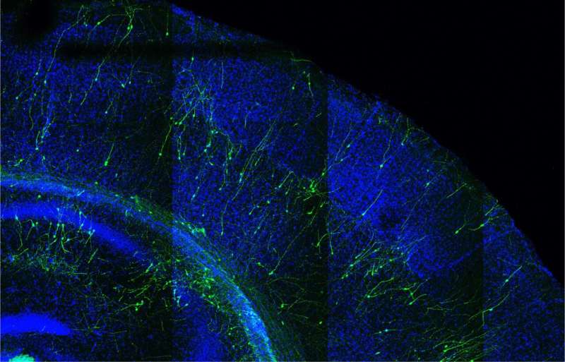 Study links premature development of human neurons to brain developmental disorders