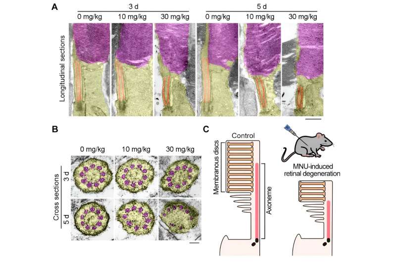 Novel mechanism of retinal degeneration