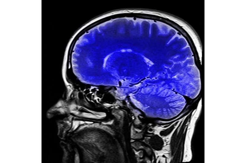 Study reveals next frontier in reproducible brain imaging for neuroscience discovery