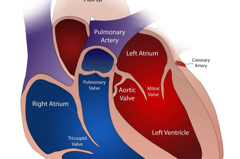 Embolic protection device may prevent some strokes during heart valve operations