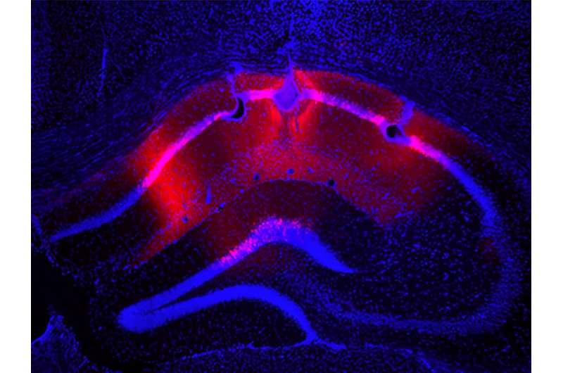 Researchers determine how the hippocampus generates and sustains oscillations