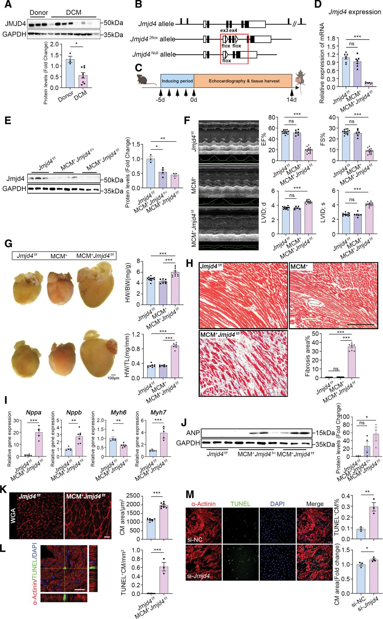 Mechanistic Insights and Therapeutic Potential of Jmjd4 in Regulating Cardiomyocyte Metabolism in Dilated Cardiomyopathy 