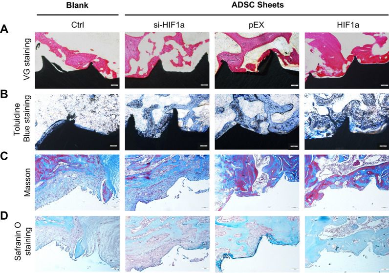 Harnessing HIF-1α signaling for vascular and bone regeneration 