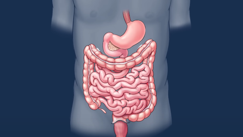 6 Warning Signs of Colon Cancer