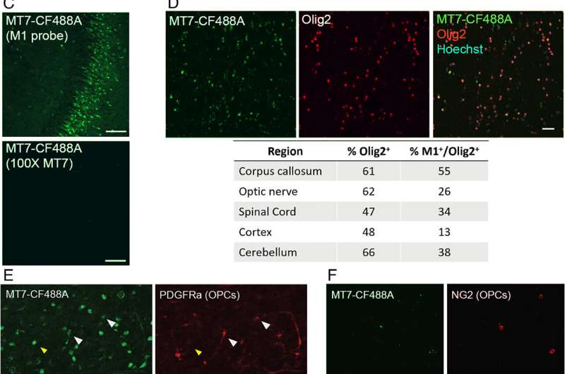 A new drug could turn back the clock on multiple sclerosis