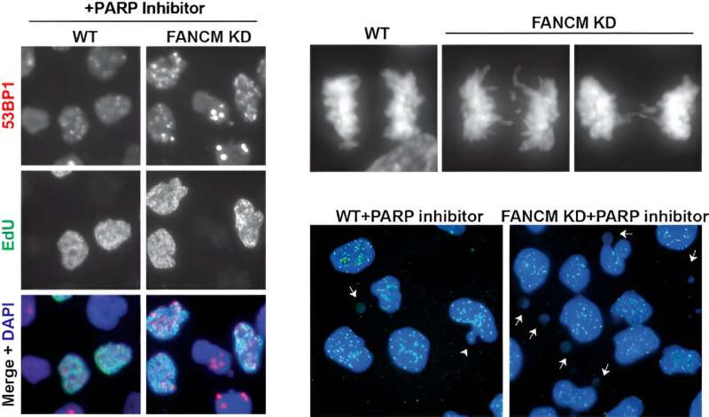 Researchers shed light on cancer drug resistance, potential to expand use of PARP inhibitors across cancer types