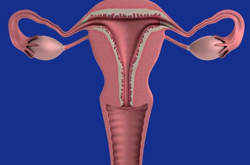 Treatment for recurrent uterine cancer advances to next research phase