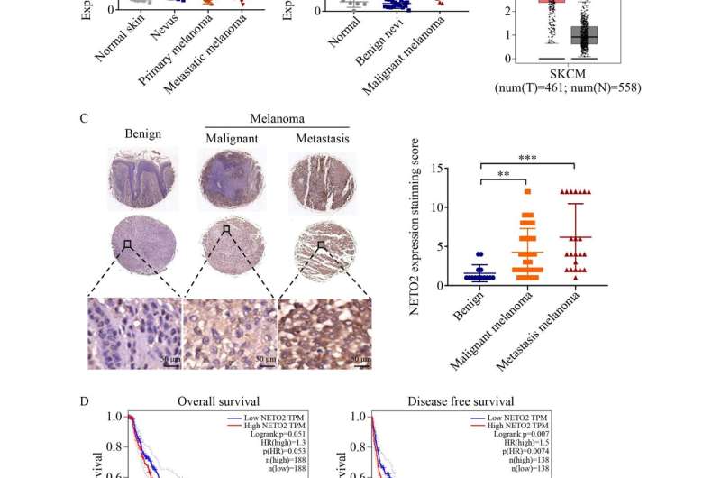 Study uncovers the role of NETO2-mediated regulation in melanoma progression