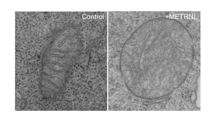 Study shows Meteorin-like protein drains energy from T cells, limiting immune system's power to fight cancer