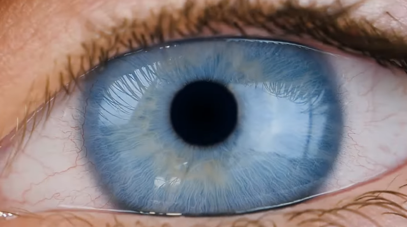 Bascom Palmer's Moon-Shot Project: An Initiative to Transplant the Whole Eye