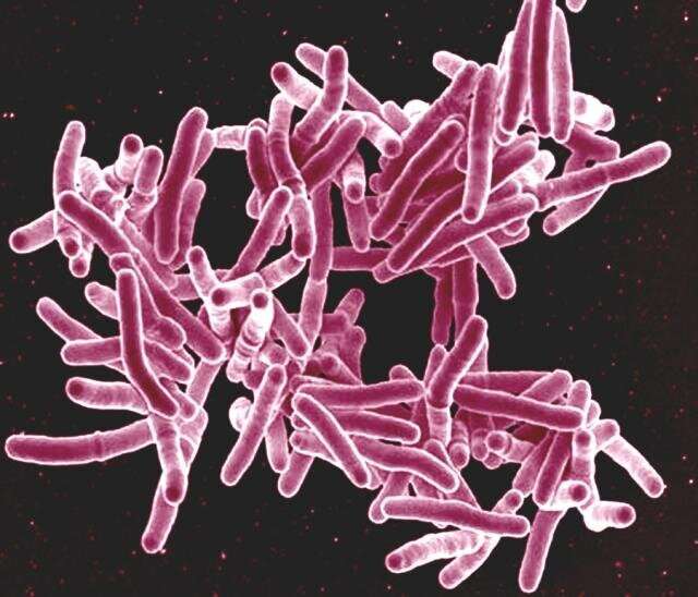 Study links TB strain infectivity to shared geographic background