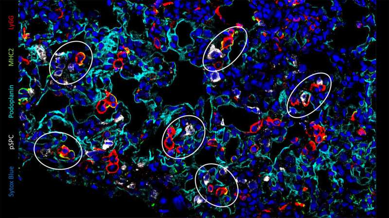 Discovery of a new population of macrophages promoting lung repair after viral infections