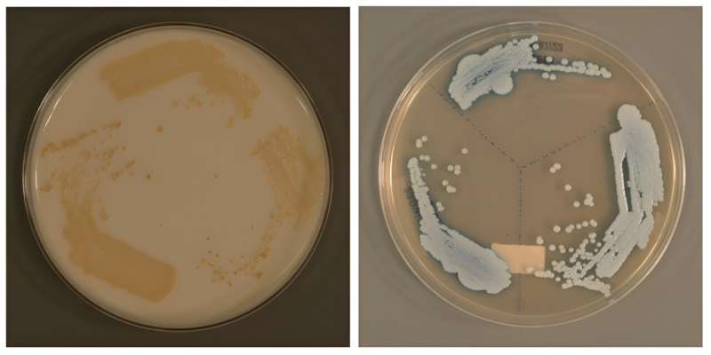 Researchers discover new Candida auris—a possible global public health threat