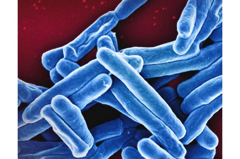 New findings on tuberculosis could change how we treat inflammatory disorders