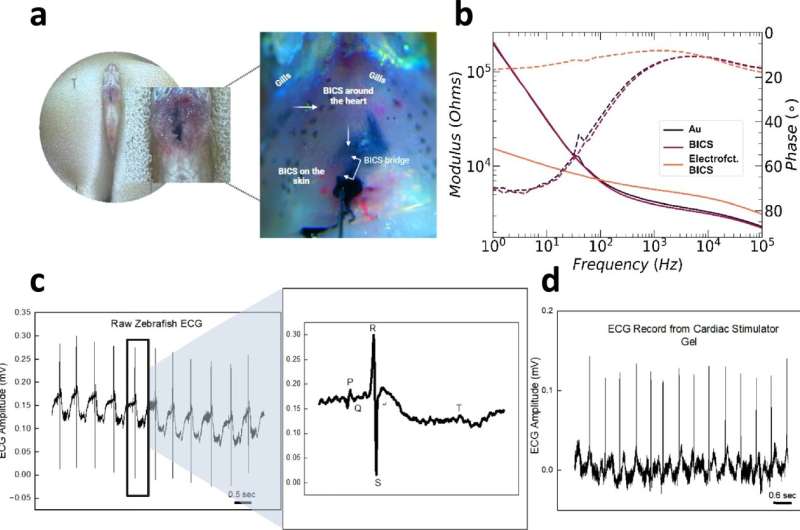 Team develops injectable heart stimulator for emergency situations