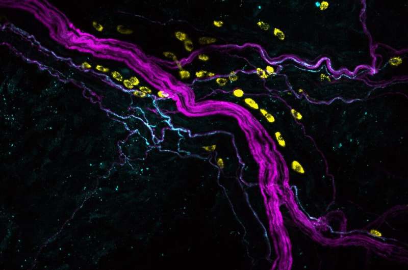 Mechanisms of postoperative pain revealed