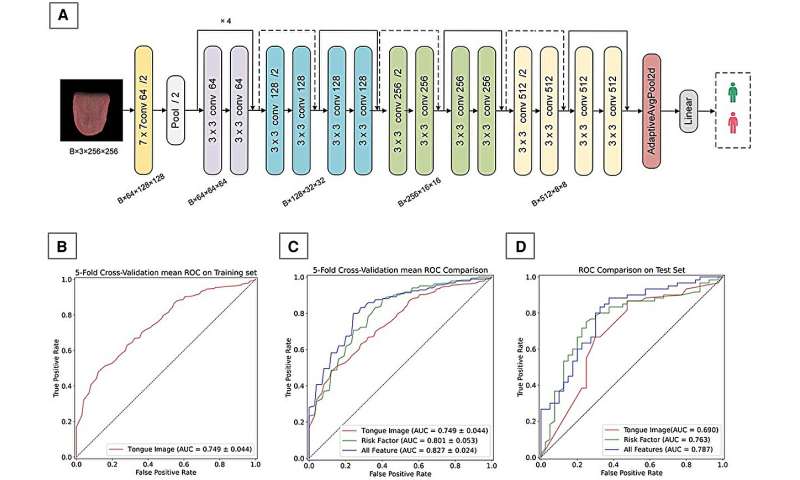 AI-based tongue imaging could help enable non-invasive detection of coronary artery disease