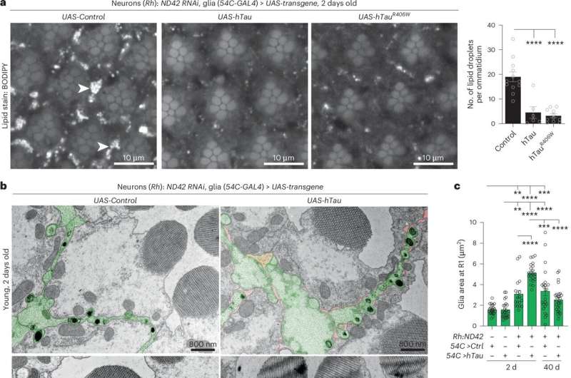 Not just a 'bad guy': Researchers discover neuroprotective function of Tau protein