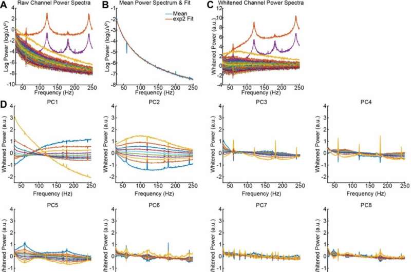 Novel algorithm improves intracranial EEG accuracy to enhance future patient care