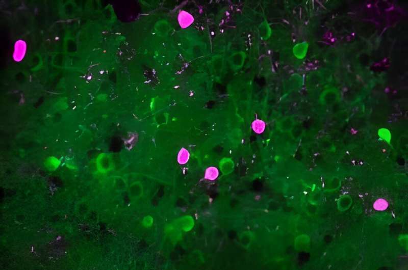 Prioritizing the unexpected: New brain mechanism uncovered