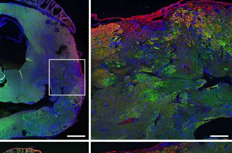 Research team discovers how Copaxone protects the heart muscle and improves its function after heart attack