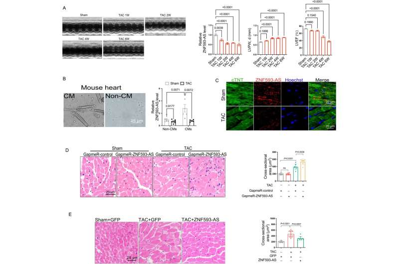 lncRNA ZNF593-AS inhibits cardiac hypertrophy and myocardial remodeling by upregulating Mfn2 expression