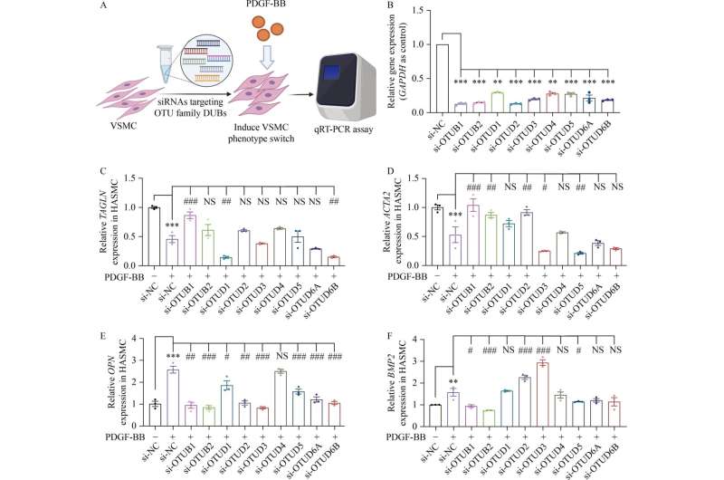 Targeting deubiquitinase OTUB1 protects vascular smooth muscle cells in atherosclerosis by modulating PDGFRβ