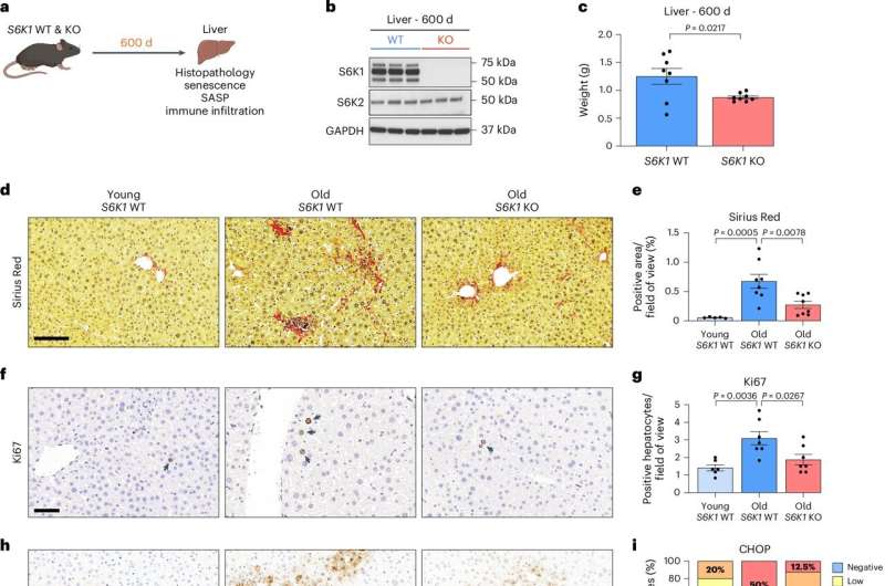 Blocking the longevity gene S6K1 extends lifespan by reducing inflammation