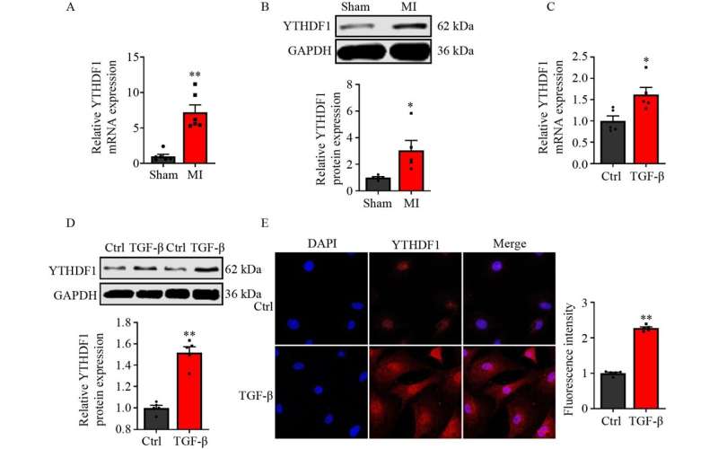 Study finds YTHDF1 promotes cardiac fibrosis by enhancing AXL translation